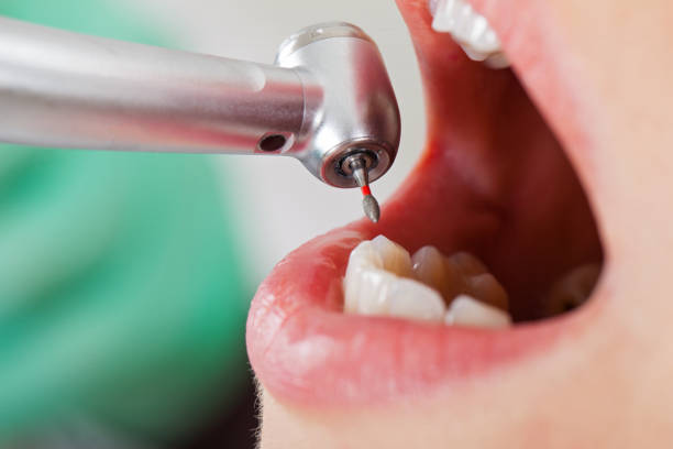 Best Emergency Care for Gum Disease in Victoria, MS